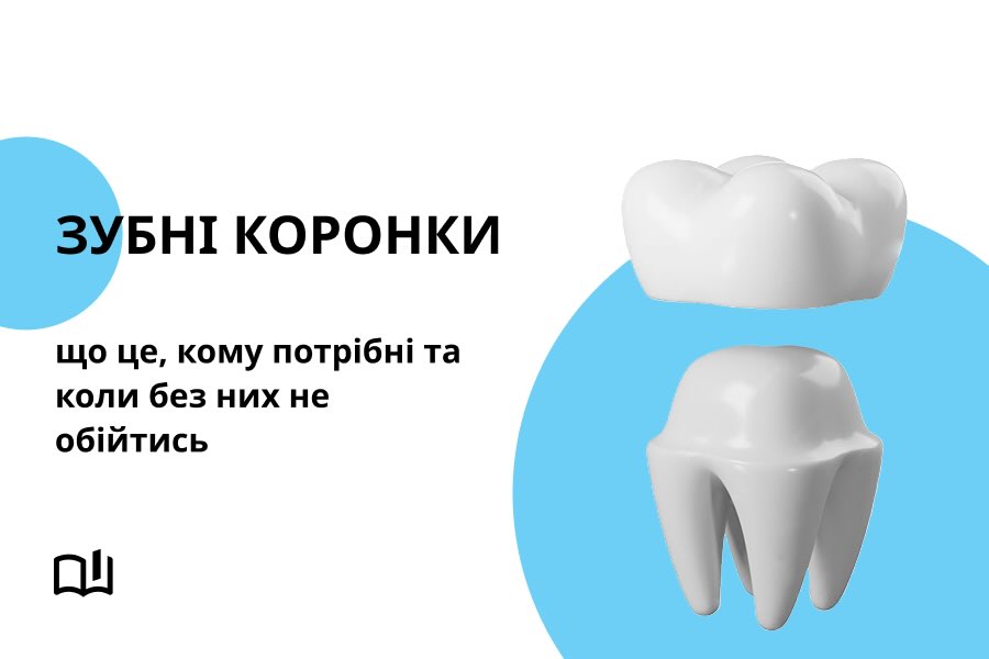 Зубні коронки: що це, кому потрібні та коли без них не обійтись